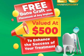Free Bone Graft With Placement of Any Implant 